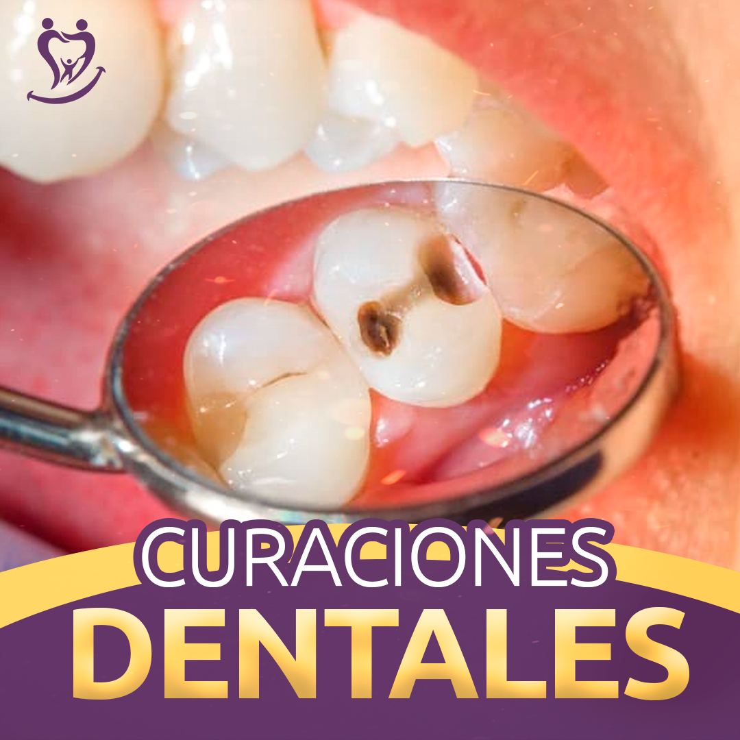 Ilustración de curaciones dentales modernas