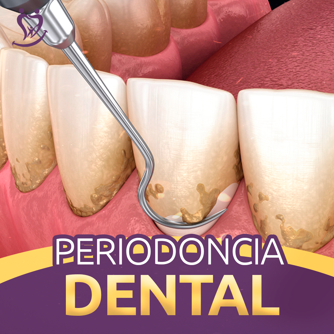 Periodoncia Dental